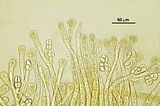 Dettaglio degli organi pluriloculari a grandi logge